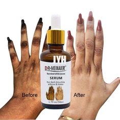De Schoonheidsmiddelen die van GMPC Bodycare de Gloedserum van het Handgewricht voor het Verwijderen van Donkere Gewrichtselleboog witten