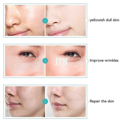 Apple-van de de Rimpelverwijdering van de Stamcel het Serum Anti-oxyderend Serum voor Gevoelige Huid