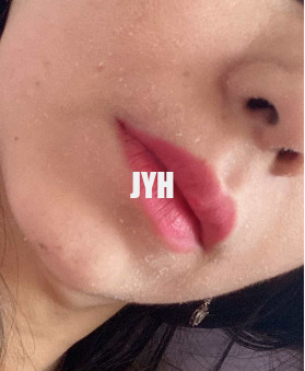 10% Glycolic Zuur die Gezichtstoner 100ml Skincare Chemische Schil hydrateren heldert Huid op