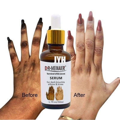 De Schoonheidsmiddelen die van GMPC Bodycare de Gloedserum van het Handgewricht voor het Verwijderen van Donkere Gewrichtselleboog witten