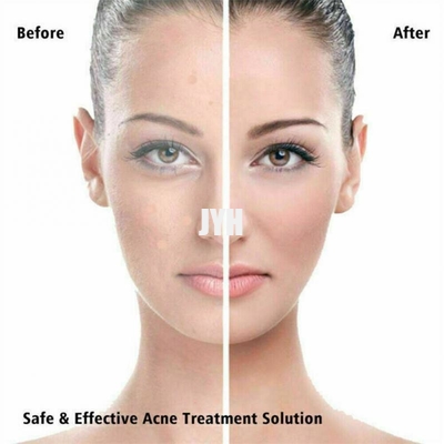 De Pukkelflard van de veganist Vriendschappelijk Hydrocolloid Acne voor het Behandelen van Zits